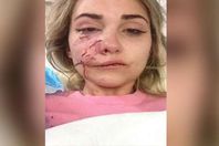 سوزيل ماكنتوش