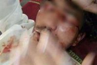 صورة الضحية