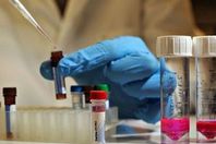 لقاح أمريكى يعالج من فيرس  " كورونا "