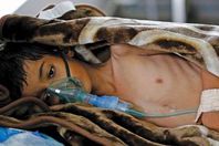 "الكوليرا" تصيب طفلًا كل دقيقة في اليمن