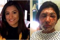 صورة المصابة ريشام