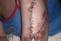 زوج مزق زوجته لطلبها الخلع بطنطا