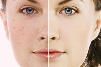 البشرة والشمس