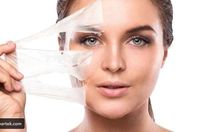 البقع السوداء