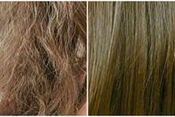 علاج الشعر التالف