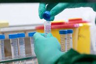 بشرى سارة.. الصحة العالمية تعلن عن دواء كورونا بالأسواق