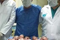 التوائم والاطباء