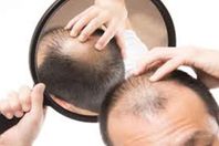 دراسة تكشف مفاجأة عن علاقة الصلع بوفيات كورونا