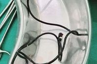 يبتلع شاحن هاتف