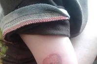 بالصور.. حضانة تعذب الأطفال حرقًا بالغردقة