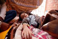 ضحايا الكوليرا في اليمن