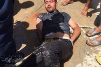 صورة المتهم عقب هجومه علي نزلاء الفندق بالغردقة