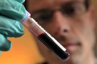 تحليل (أرشيفية)