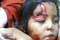 الكلاب الضاله  تغزو شوارع " كفرالزيات والمحلة وطنطا " ... والأهالى "عايزين مسؤول ينقذنا"