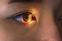 الاصابة بالعمي