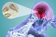 الأميبا آكلة الدماغ