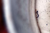 إصابة 11 شخصًا بحمى الضنك في فلوريدا 
