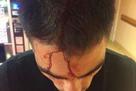 مصرى يضرب اسرائيلى