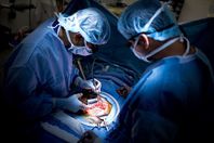 تجارة الاعضاء