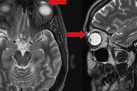 صور من العملية