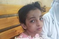 طفلة التعذيب