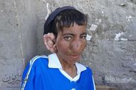 أحدب بني سويف