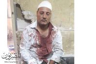 اصابة أمين شرطة بـ " 41 غرزة " بعد الاعتداء علية من قبل بلطجية فى المحلة الكبرى