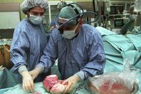 التبرع بالاعضاء