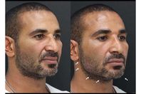 أحمد سعد تجميل