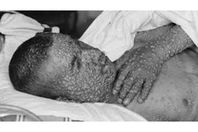 قتل 100 مليون شخص في الماضي.. الطاعون الأسود يظهر في الصين مجددا
