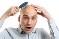 المخنثون لا يصابون بـ«الصلع»