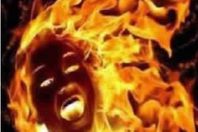 رجل يحرق زوجته البرازيلية بالكحول