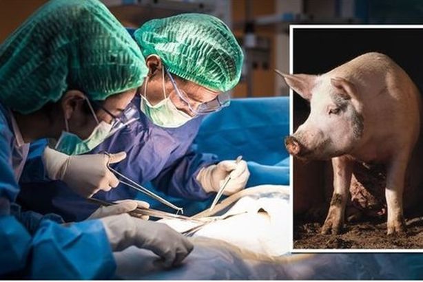 us-surgeons-transplant-pig-kidney-human-nuy-langine-health-1509341