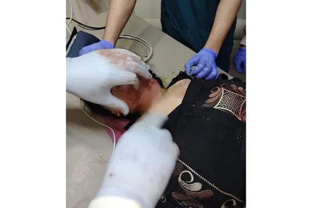 معجزة طبية.. شاب يذبـ.ـح ابنة عمه داخل المستشفى بعد حملها سفاحًا والأطباء ينقذونها(صور) 1000660285_793_064443