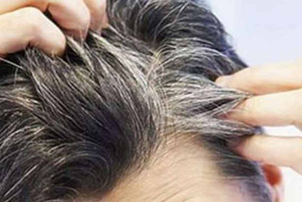 الشعر الأبيض