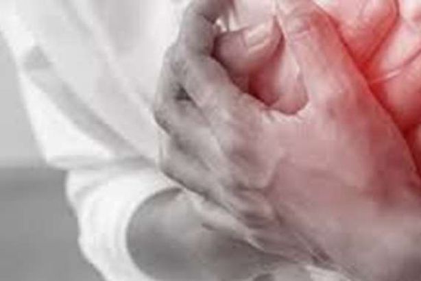 النوبة القلبية