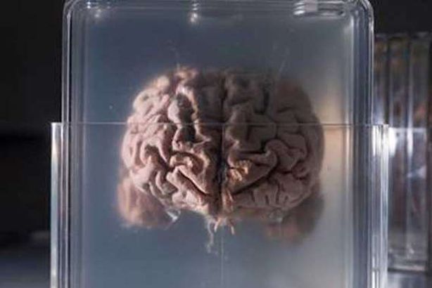 تجميد الأعضاء البشرية