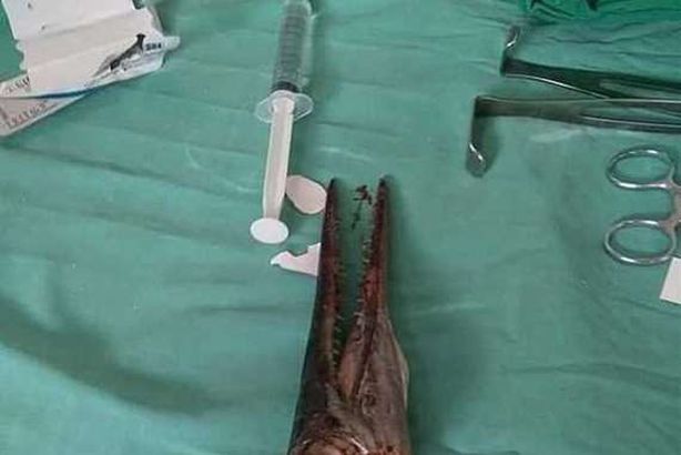 سمكة الإبرة