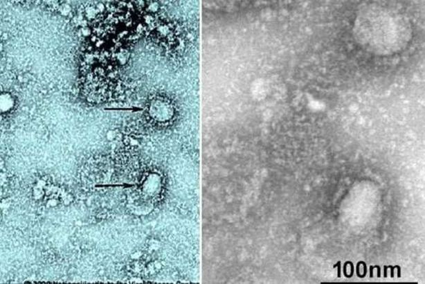 فيروس كورونا