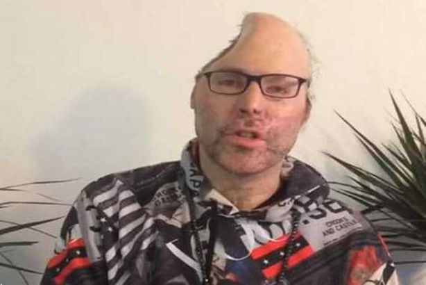 مغني الراب الألماني "نيكو بي"