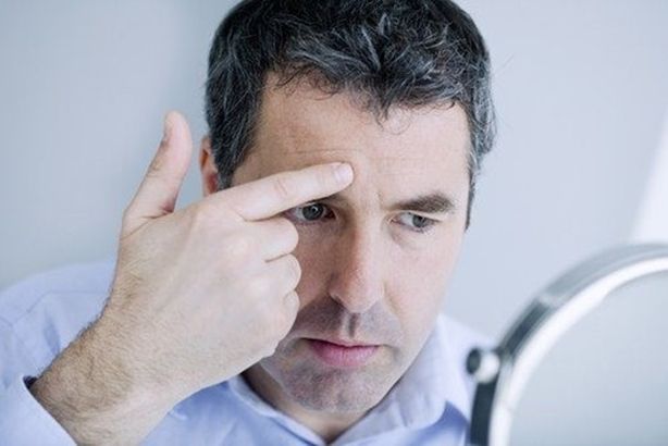 علاج-تجاعيد-الوجه-للرجال