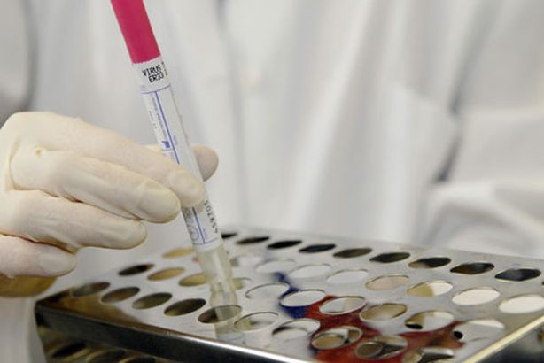 ظهور اول حالة مصابة بفيروس كورنا بمستشفى العباسية