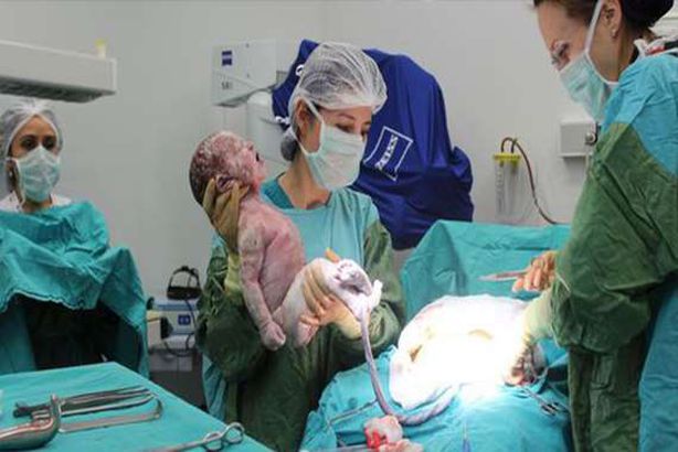 عملية قيصرية