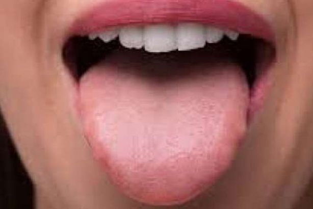 تنميل اللسان 
