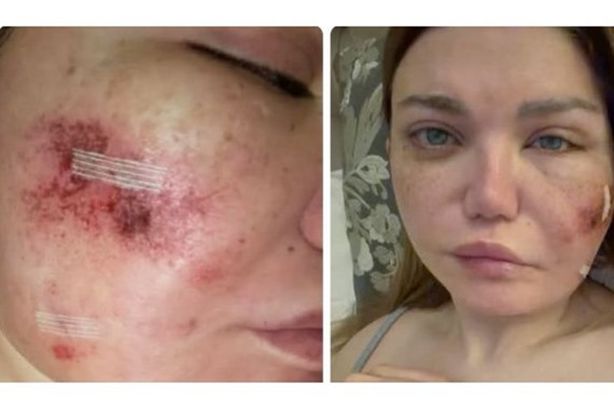 6202055615386202602250634543454