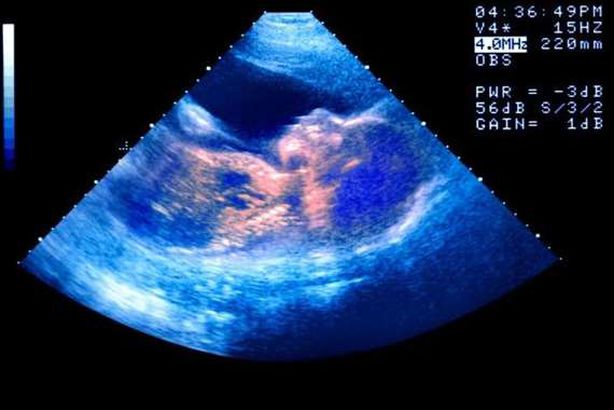 التنقيح الصناعي