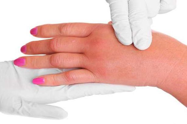 ورم الجسم من الاملاح