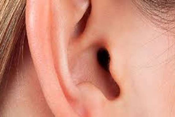 تجاعيد الأذن 
