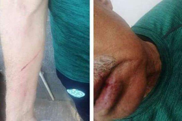 الاعتداء على بعثة الرجاء