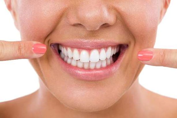 تبييض الأسنان

